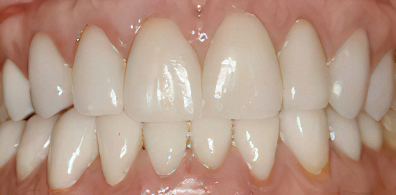 Dentist in East Brunswick