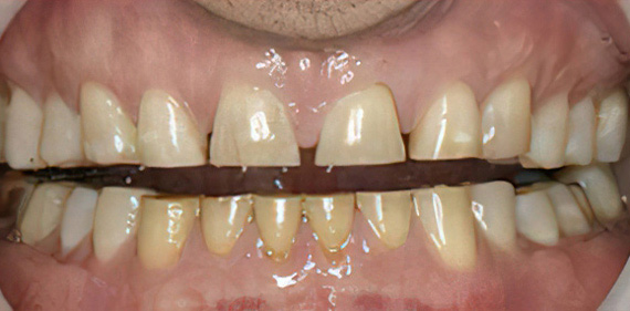 Family Dentist in East Brunswick