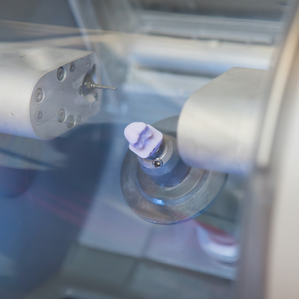 CEREC Dentist in East Brunswick