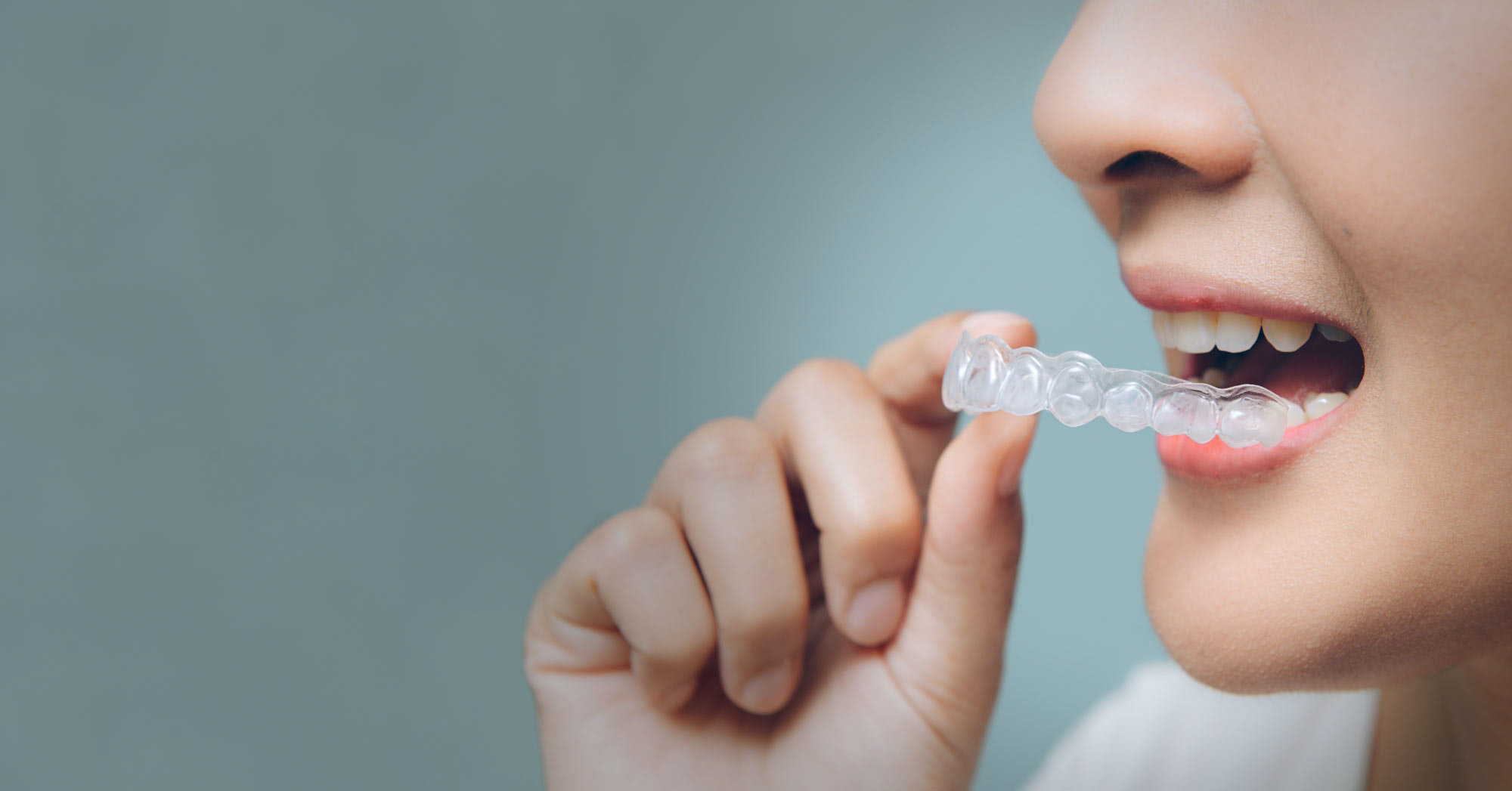 Clear Aligners East Brunswick