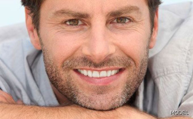 East Brunswick Dental Crowns