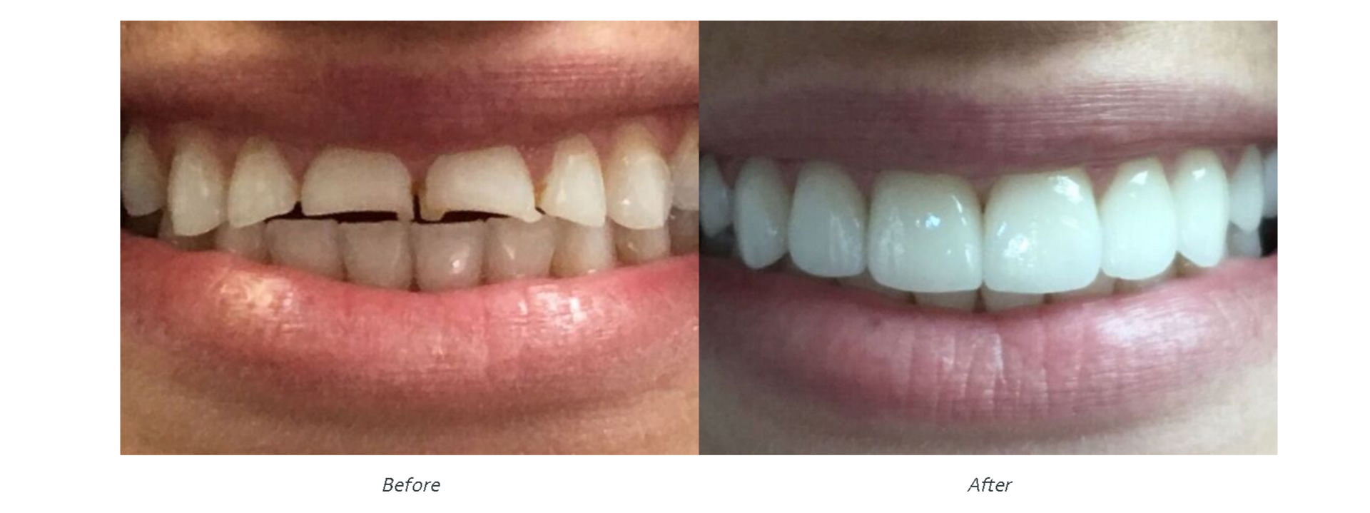 Cosmetic Dental Office East Brunswick