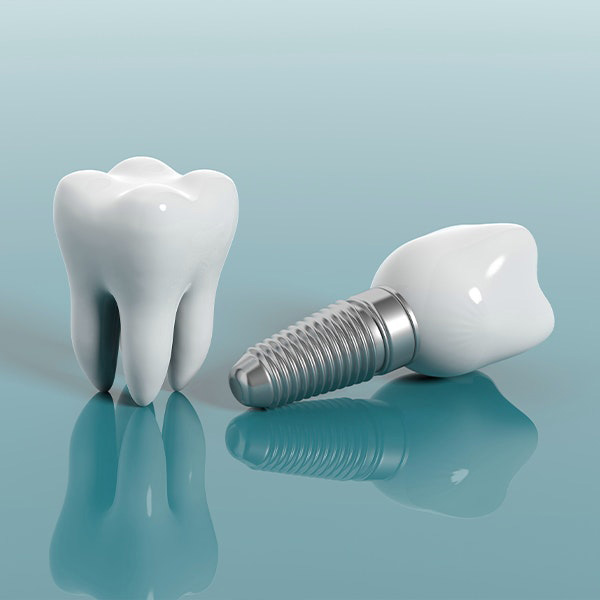 Dental Implants Dentist in East Brunswick